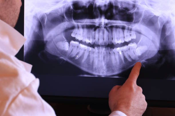 Best Emergency Treatment for Oral Infections in Hilliard, FL